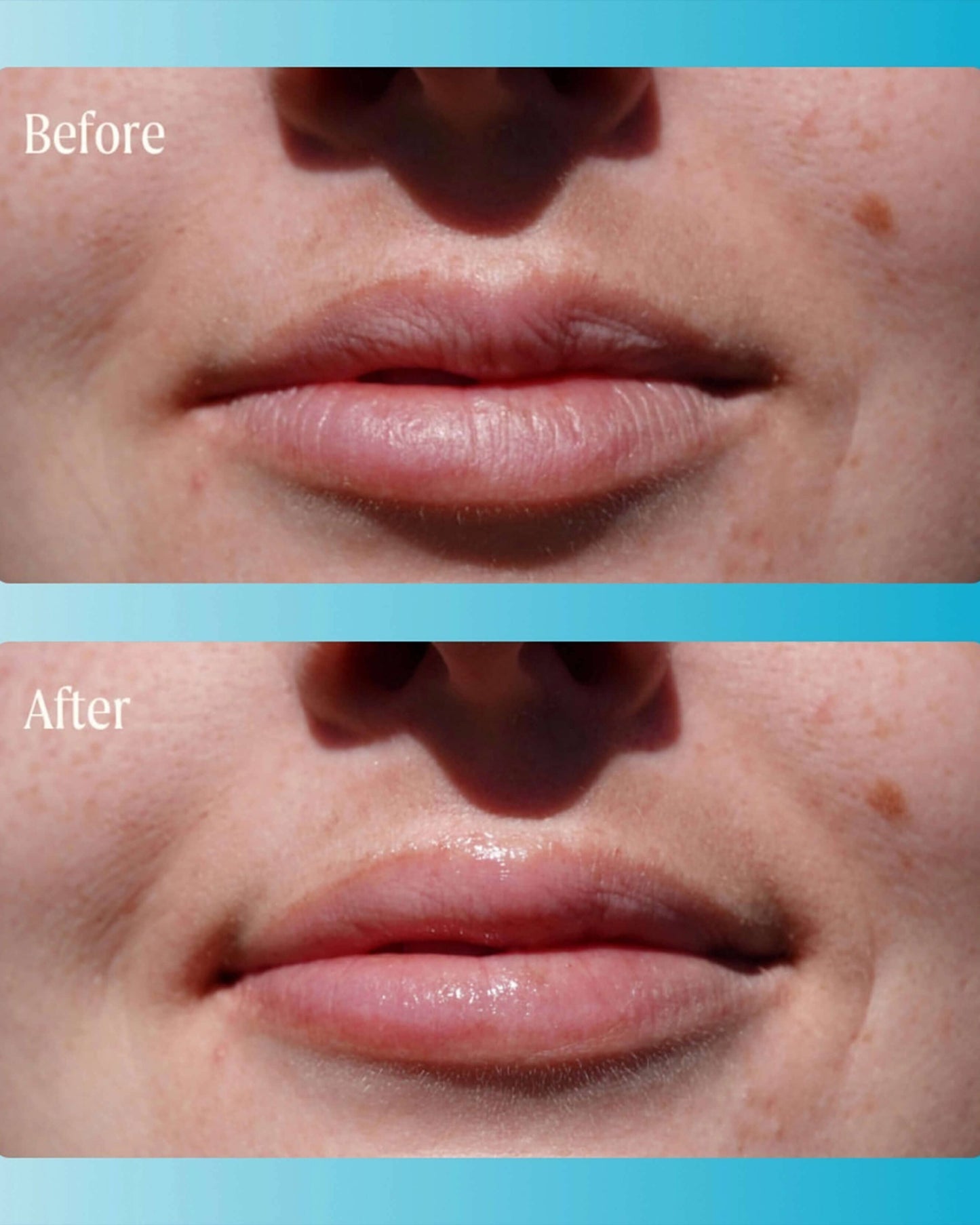 Supermelt Hyaluronic Plumping Lip Treatment