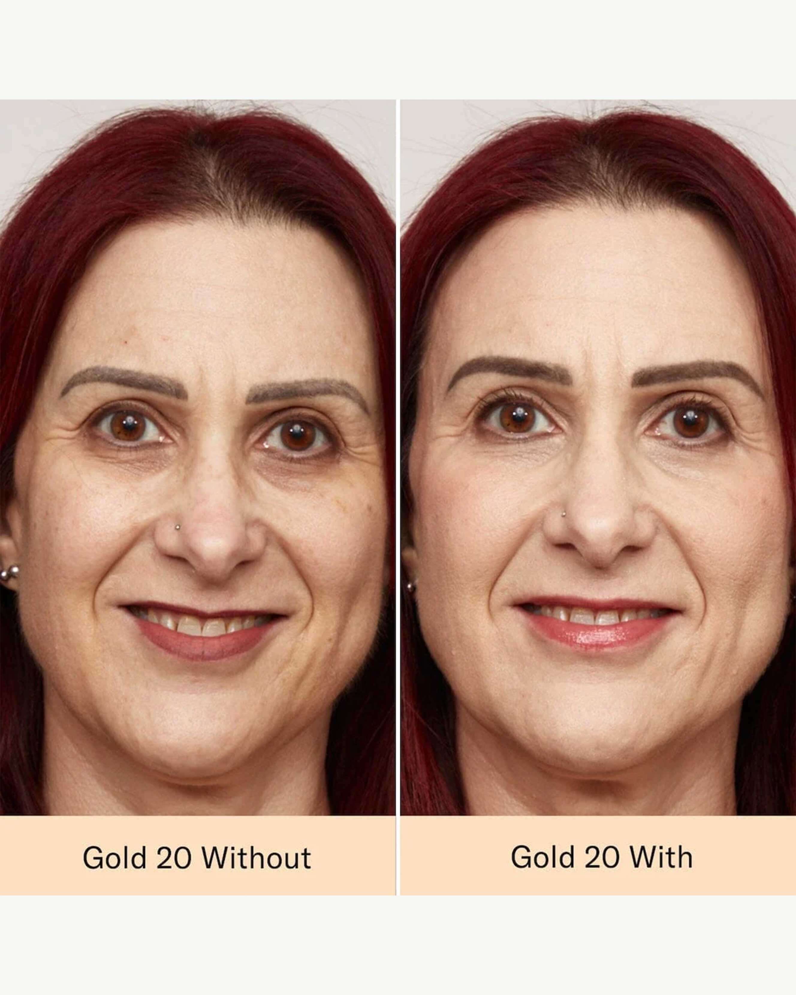 Gold 20 (fair to light with gold undertones)