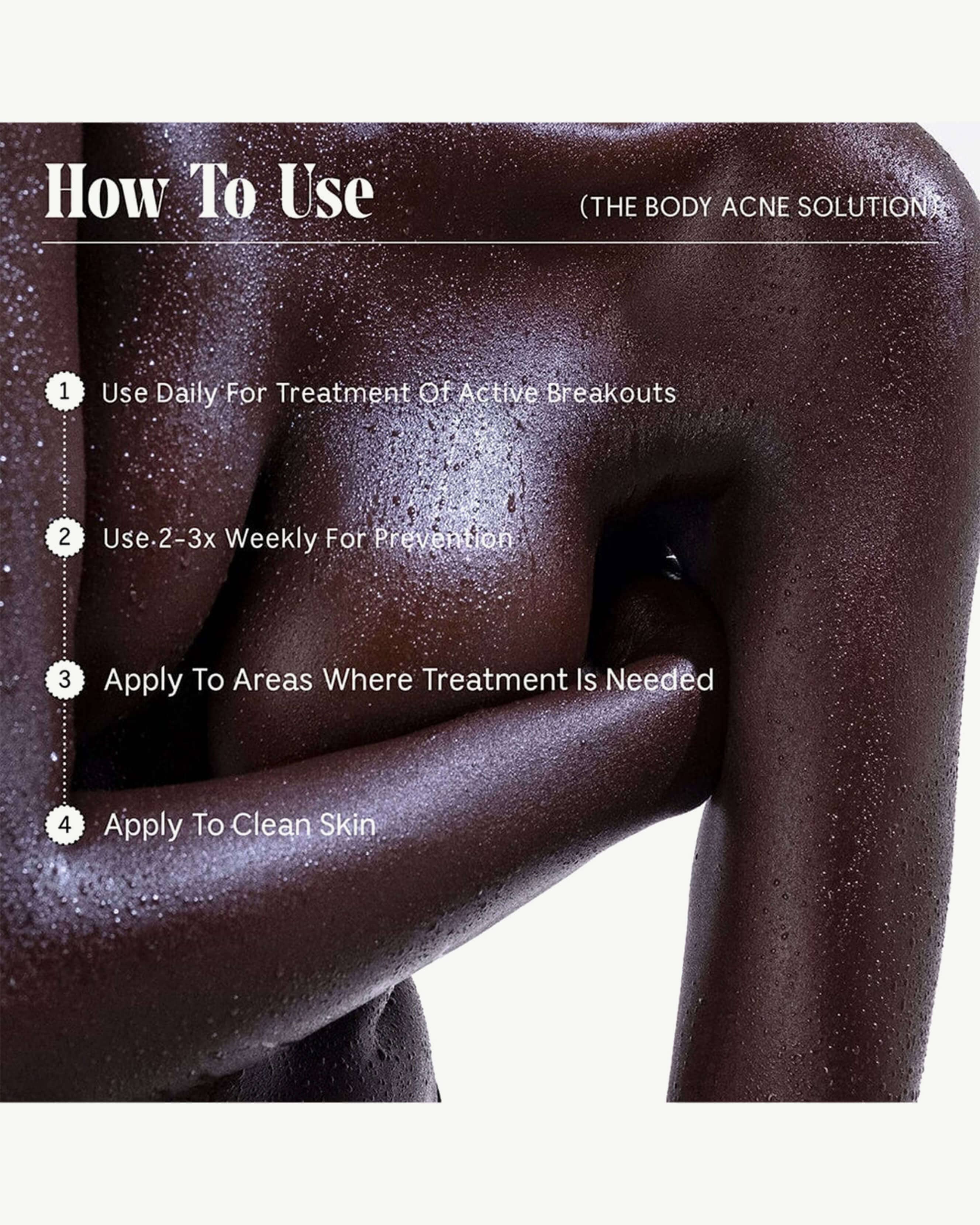 The Body Acne Solution