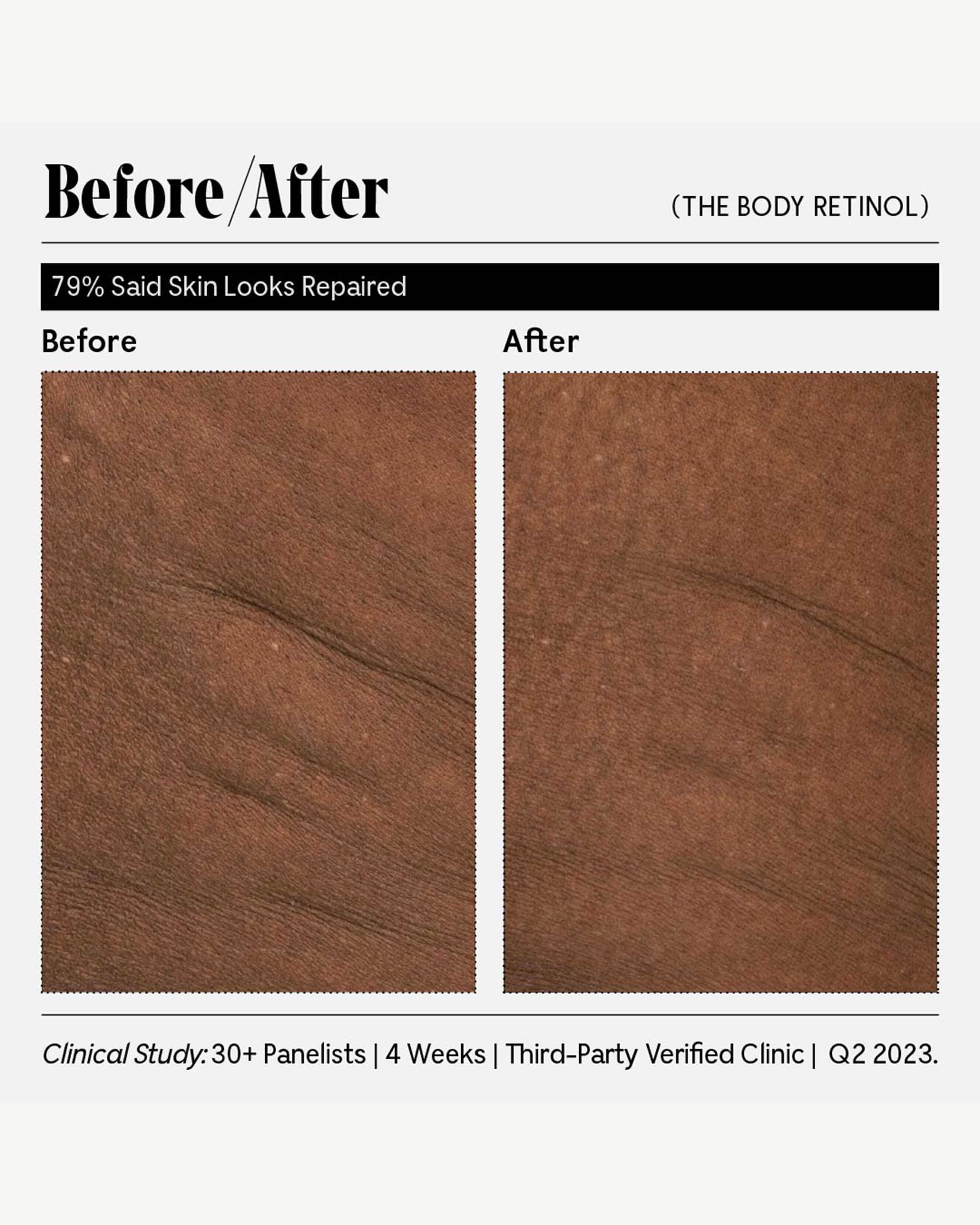 The Body Retinol