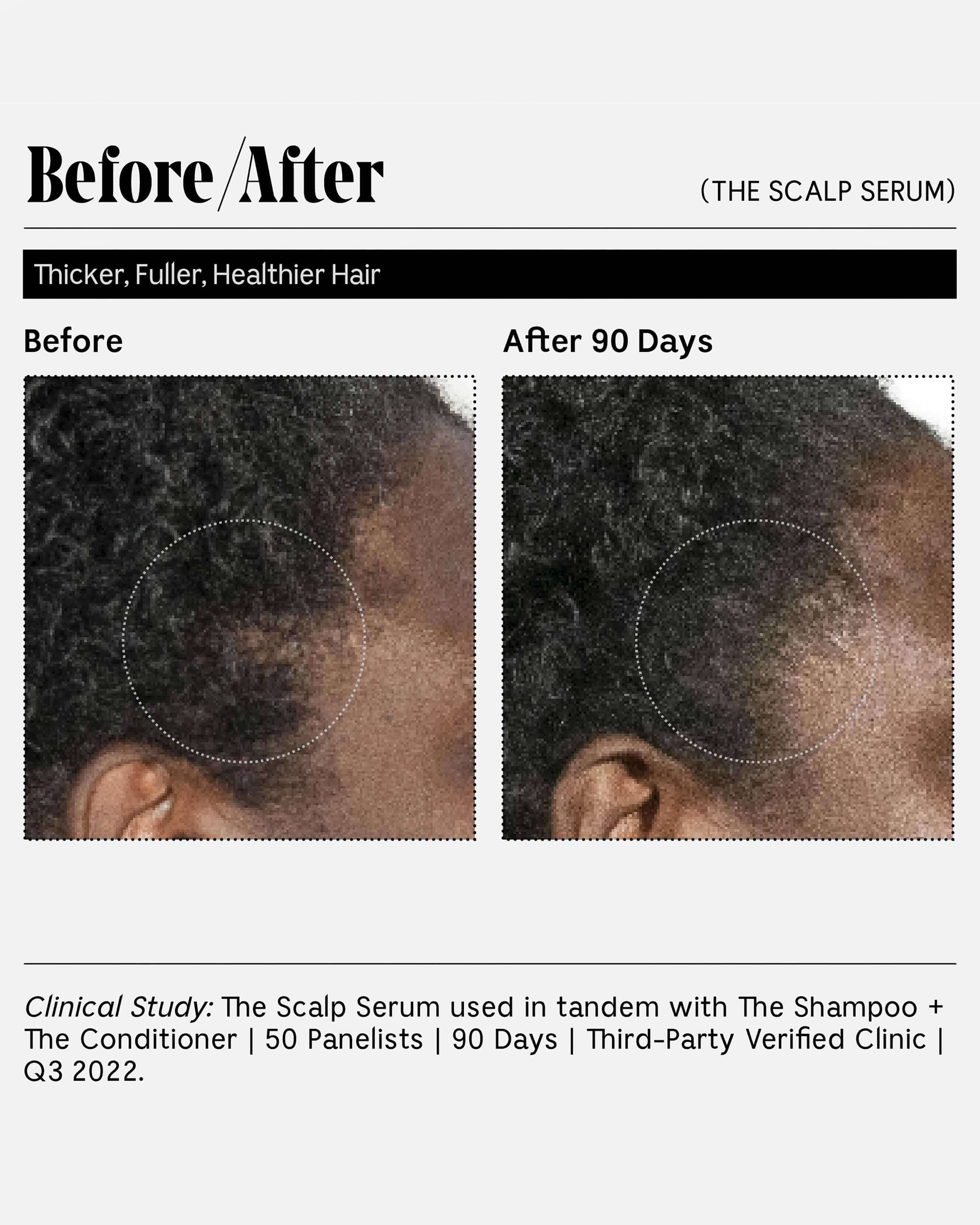 The Scalp Serum