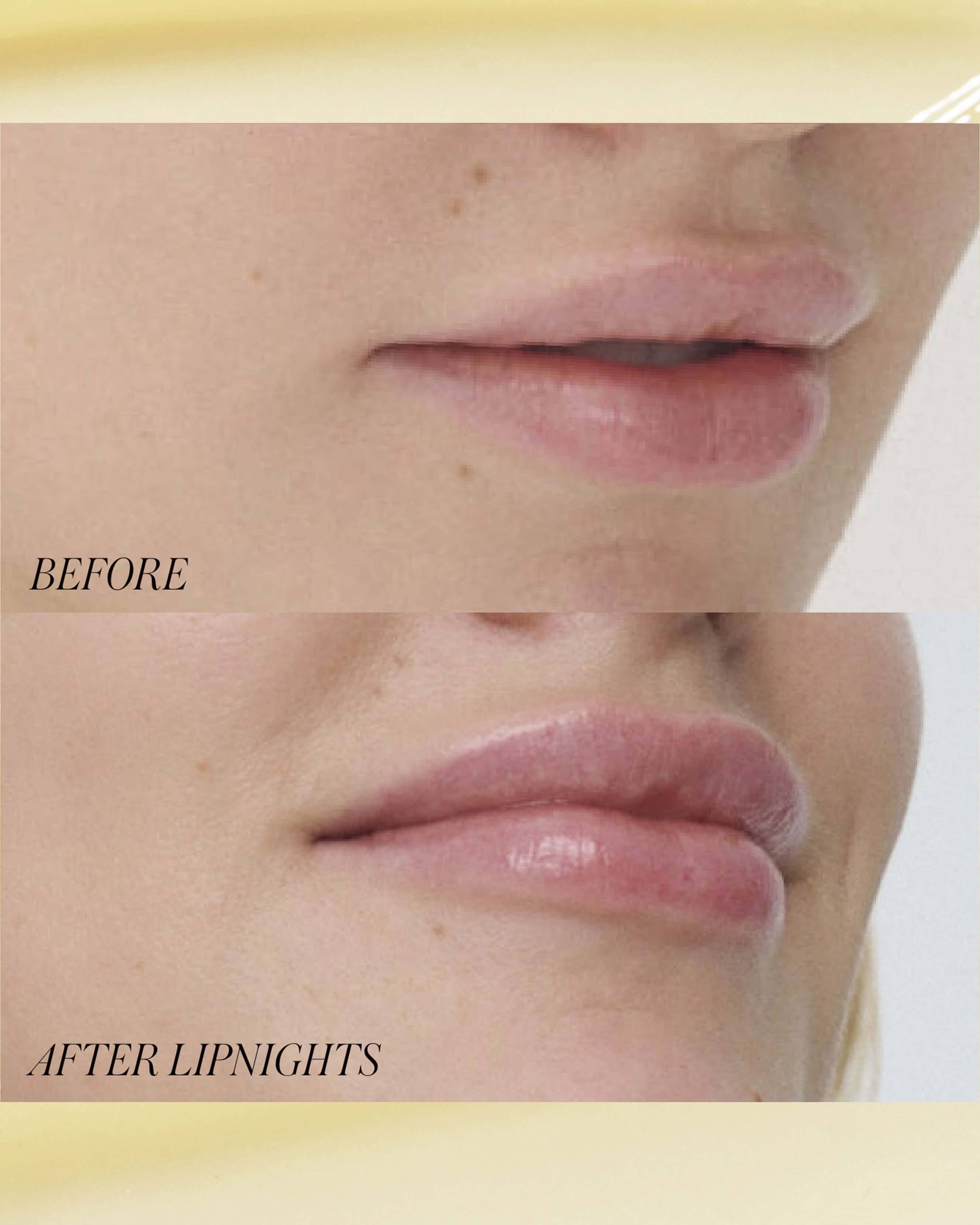 Lipnights Overnight Lip Mask