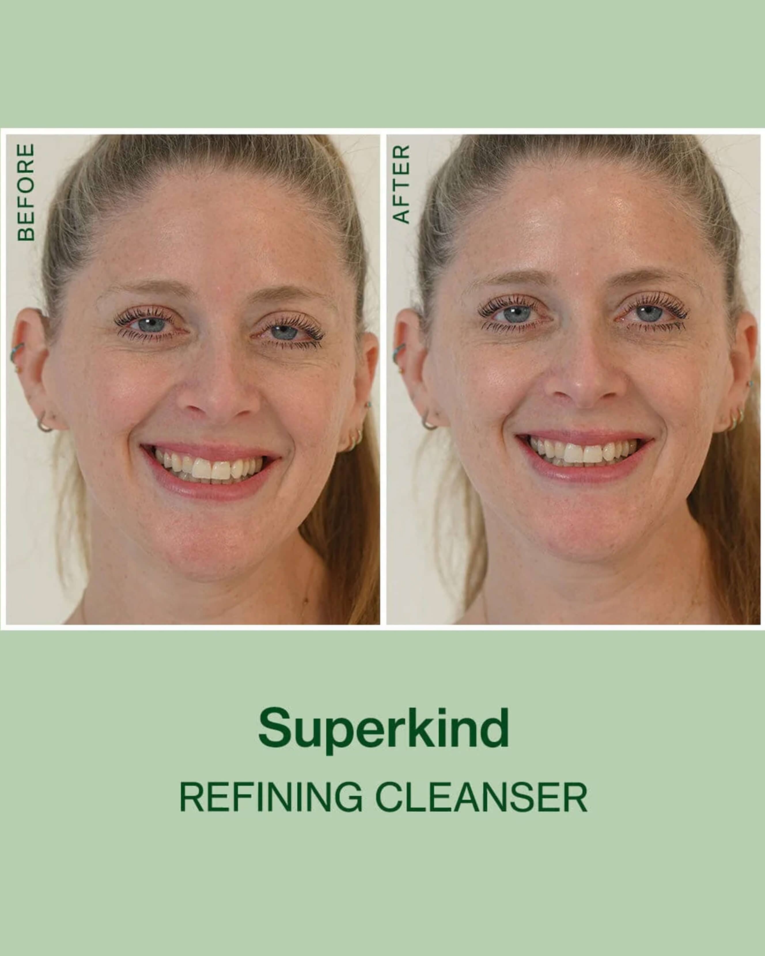 SUPERKIND Refining Cleanser