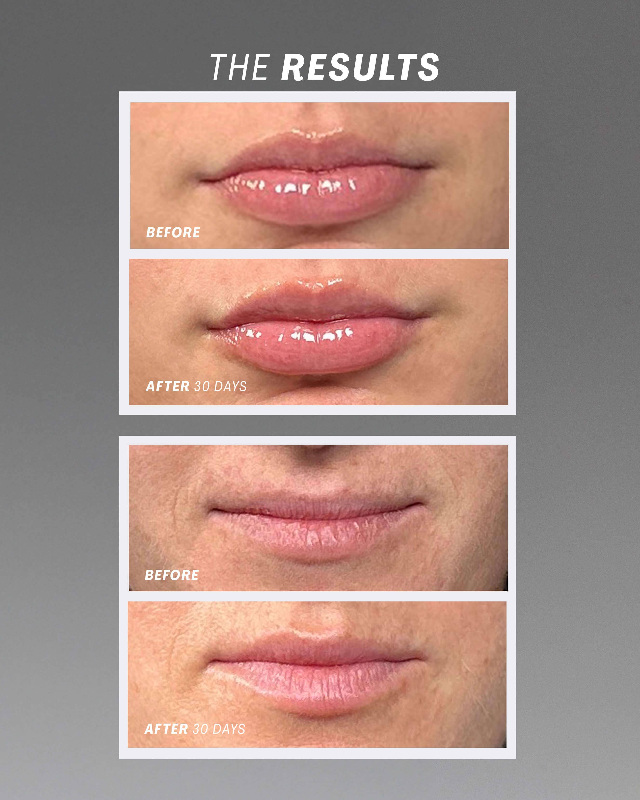 Lip Oasis™️ Glossy Treatment