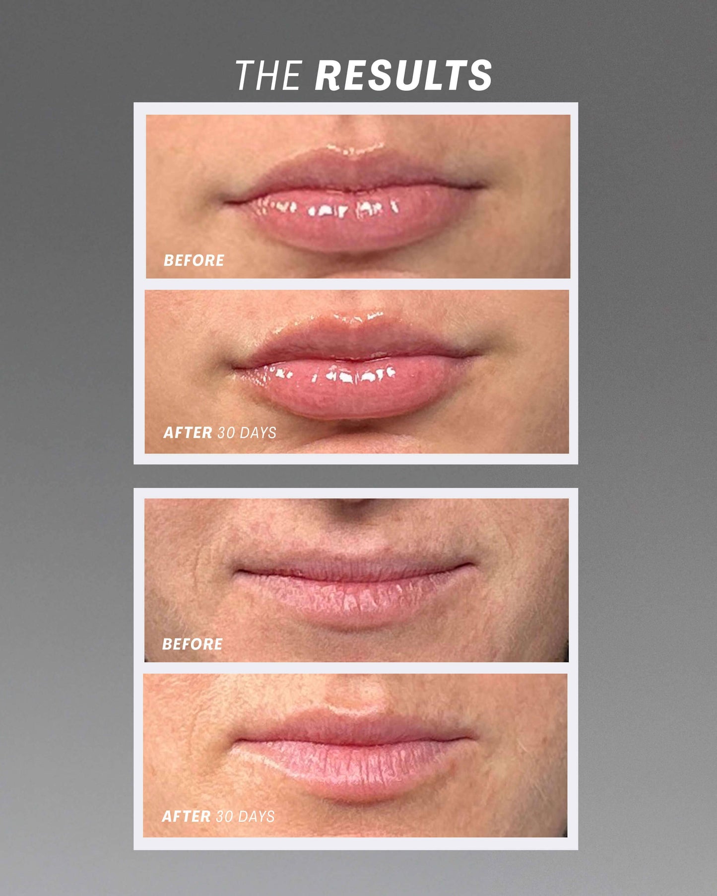 Lip Oasis™️ Glossy Treatment