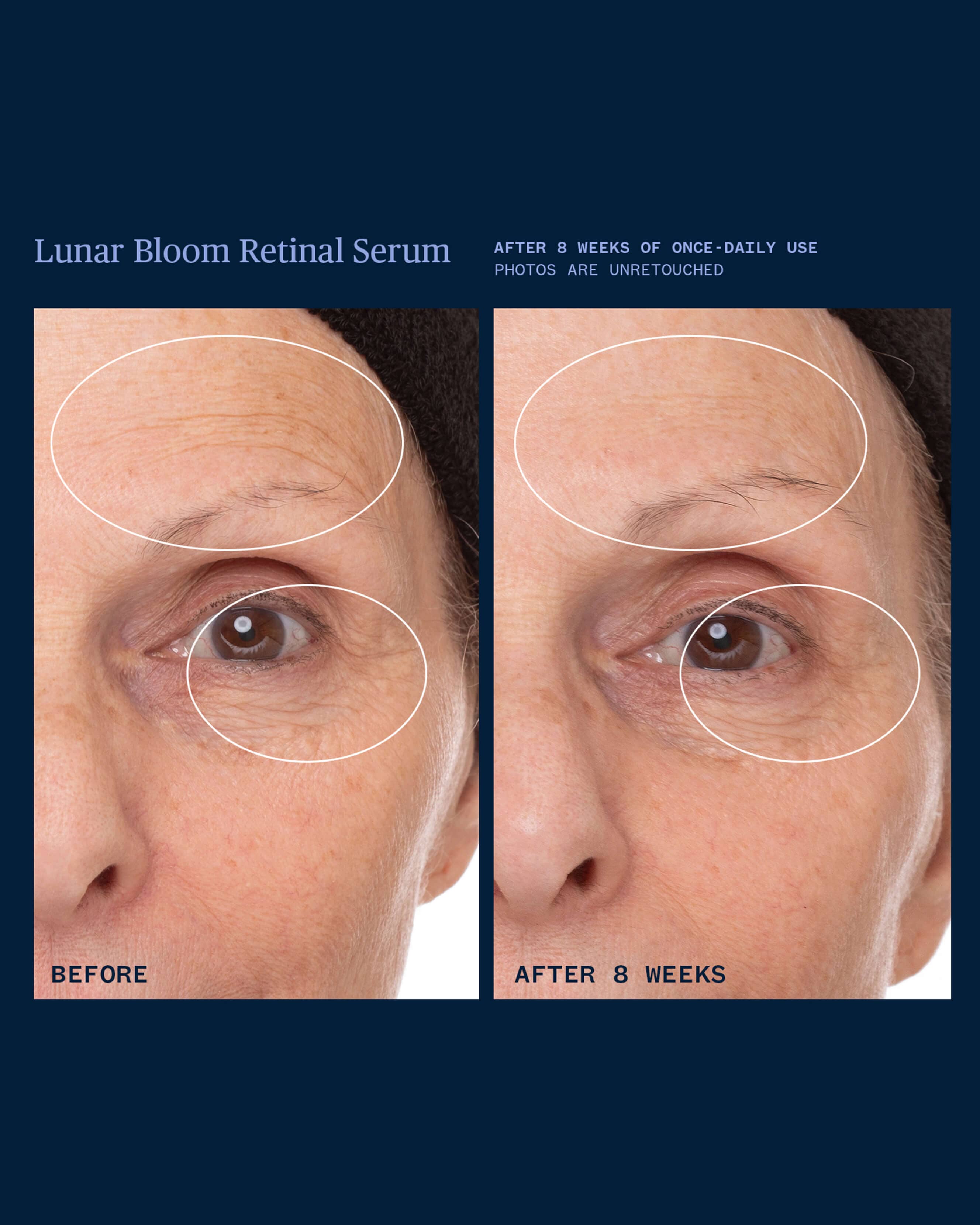 Lunar Bloom Retinal Serum