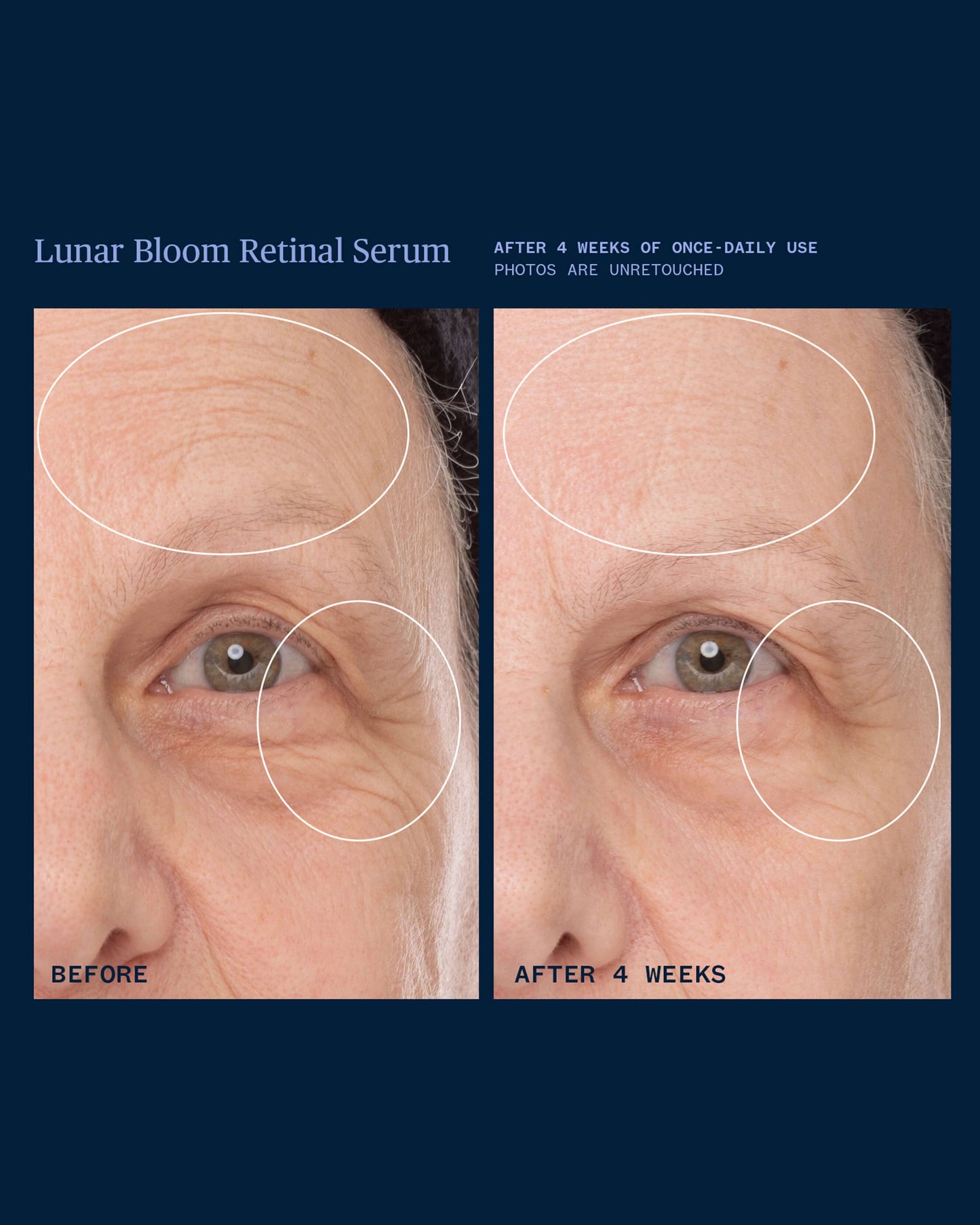 Lunar Bloom Retinal Serum