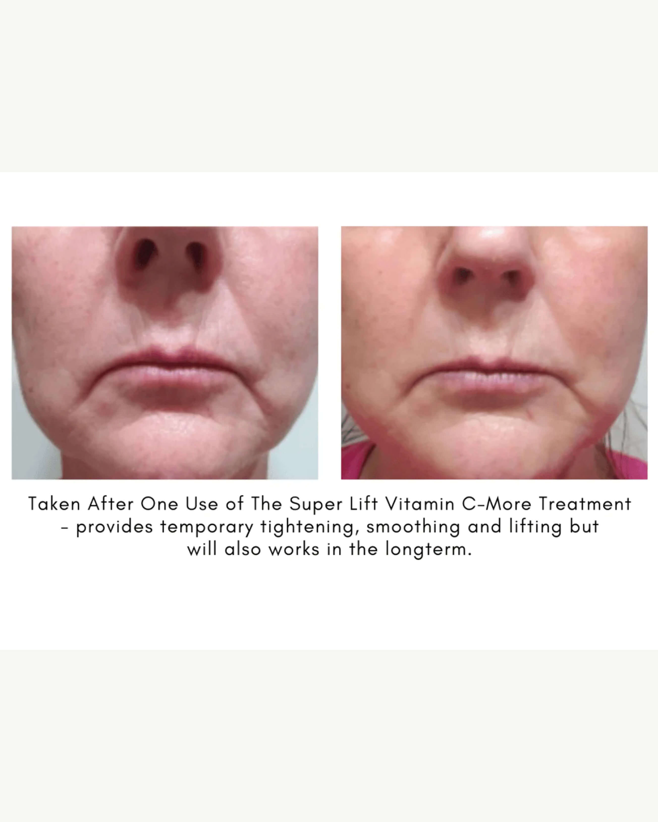 The Super Lift Vitamin C-More Treatment